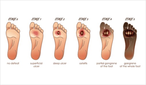 Power-Stem Biomedical Research_Diabetes Research1